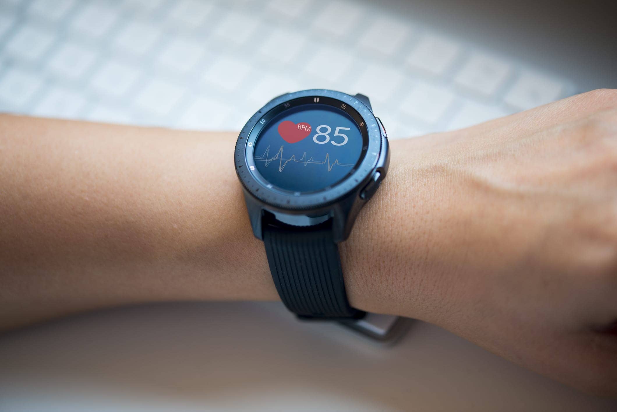 ClinicalGrade Smart Watch Accurately Detects Atrial Fibrillation Cardiology Innovations