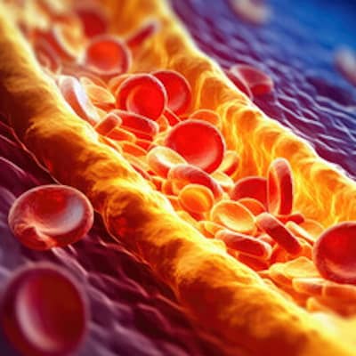 Unveiling the Power of Agatston Scores: A New Dawn in Predicting Coronary Heart Disease