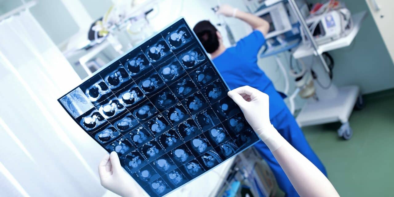 Unveiling the Role of Preprocedure Imaging in Left Atrial Appendage Occlusion