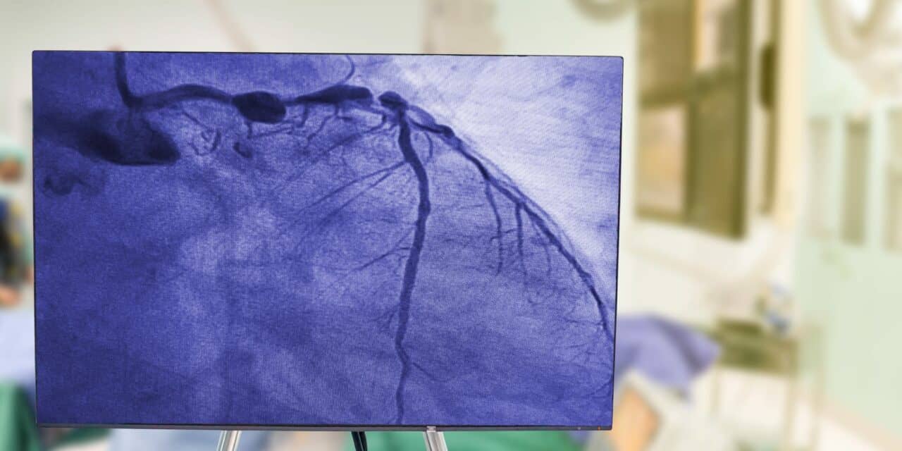 Long-Term Comparison of PCI and CABG in Multivessel CAD Patients