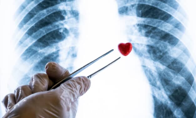 Surgeon Performs World’s First Deep Venous Stent Thrombectomies Using Minimally Invasive Catheter