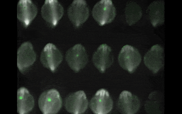 Heart Cells Start Beating Abruptly at Once, Surprising Researchers
