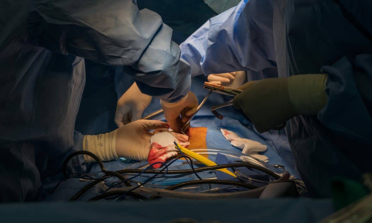 Heart Transplants Safer Than Thought for Adults with Single-Ventricle CHD