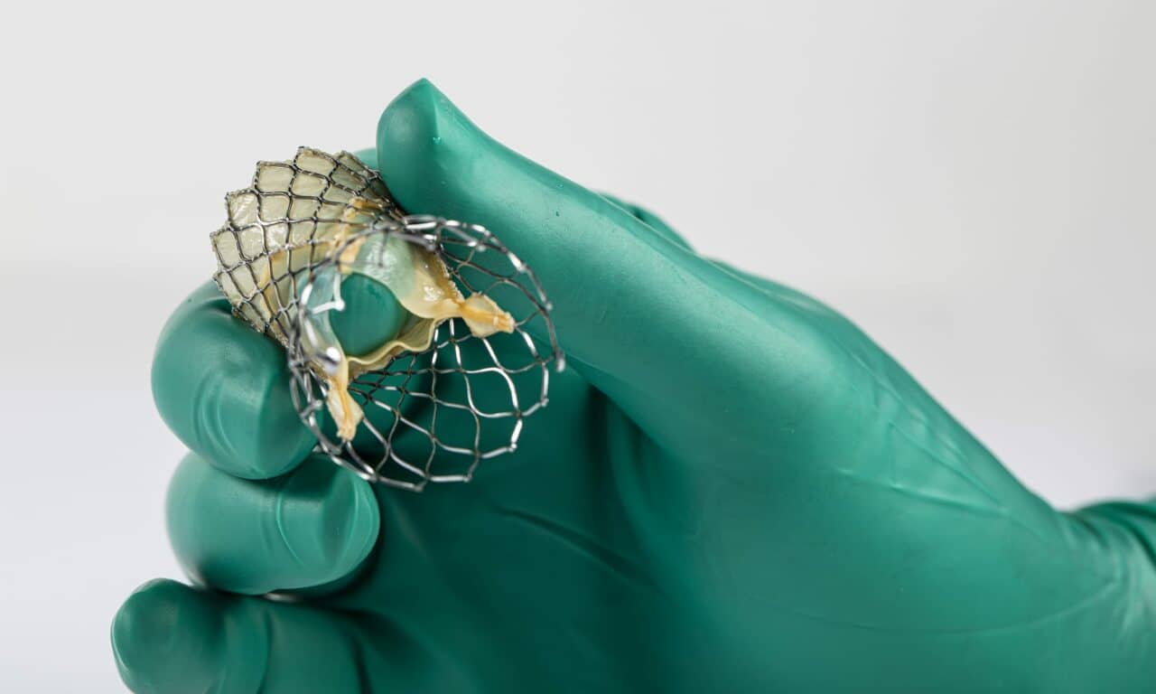 Nonsurgical Heart Valve Procedures Surge Among Young Patients, But at What Cost?