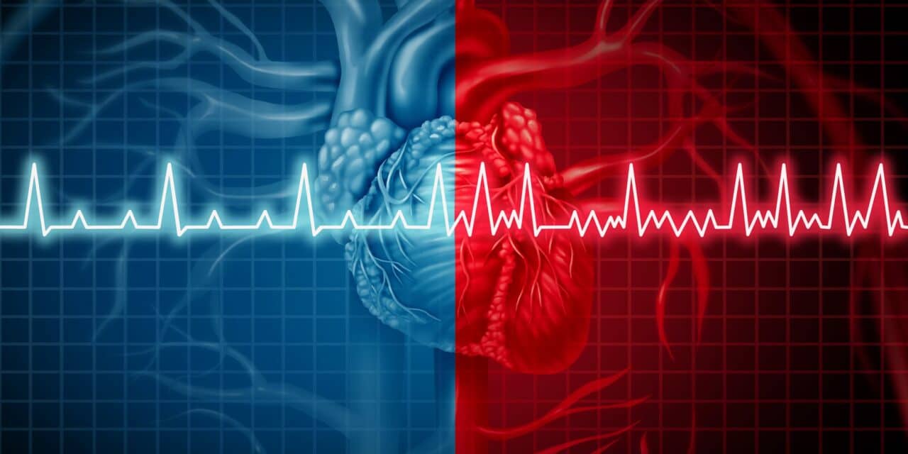Patients With Persistent AFib Are More Likely to Have These Risk Factors