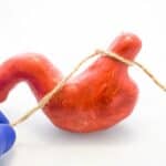 Bariatric Surgery Beats Medication in Long-Term Hypertension Control