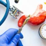 Bariatric Surgery Linked Significant Cardiometabolic Improvements
