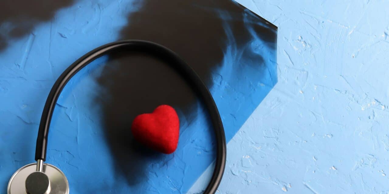 Deep-Learning Model Improves 10-Year Cardiovascular Event Risk Prediction