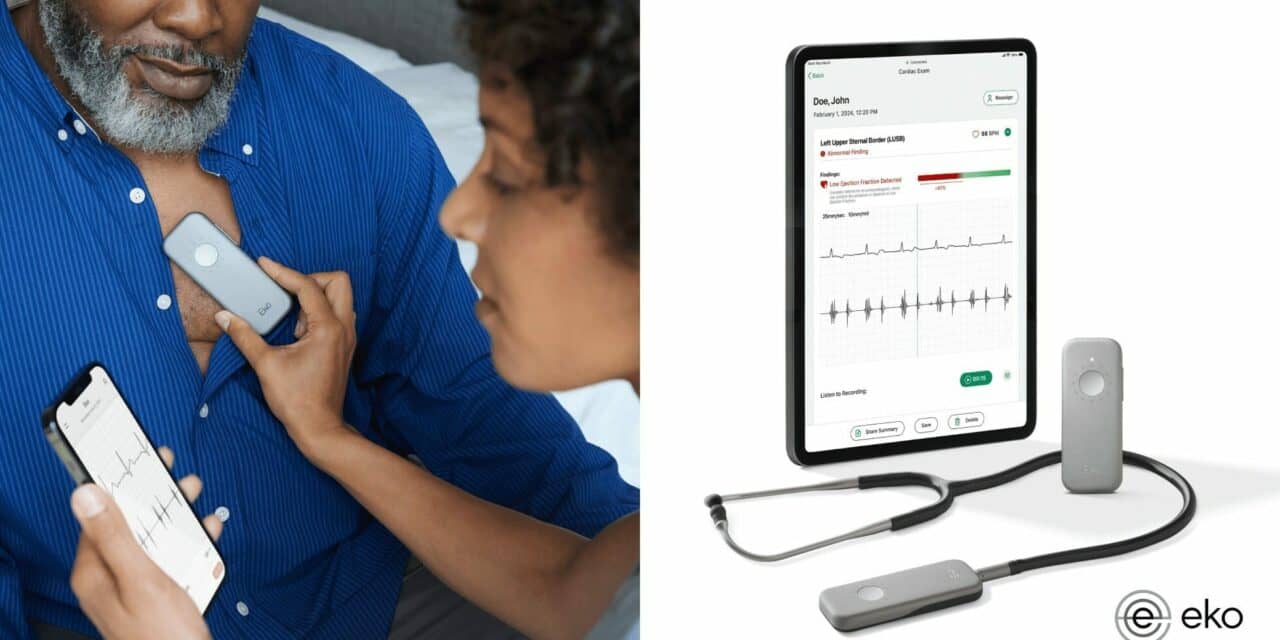 FDA Clears AI to Detect Heart Failure During Routine Check-ups