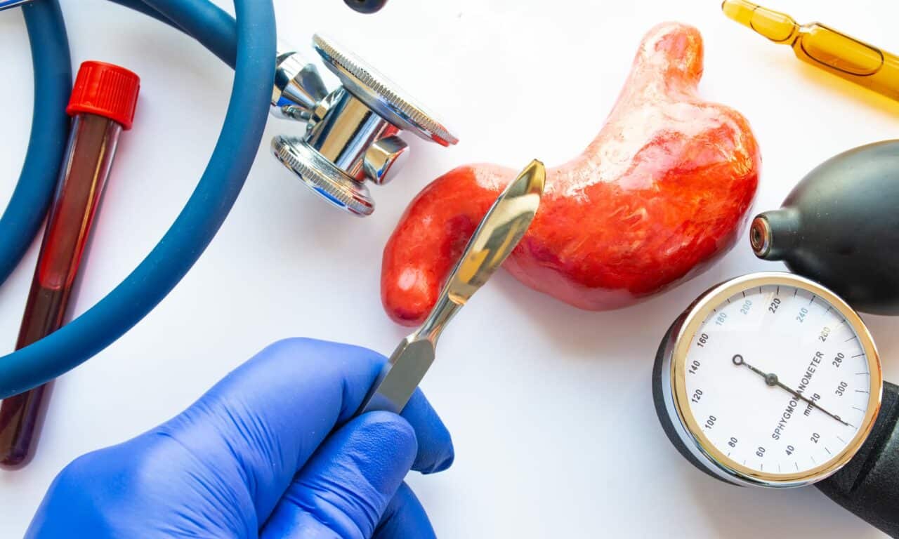 Bariatric Surgery Slashes Cardiovascular Risks for Sleep Apnea Patients
