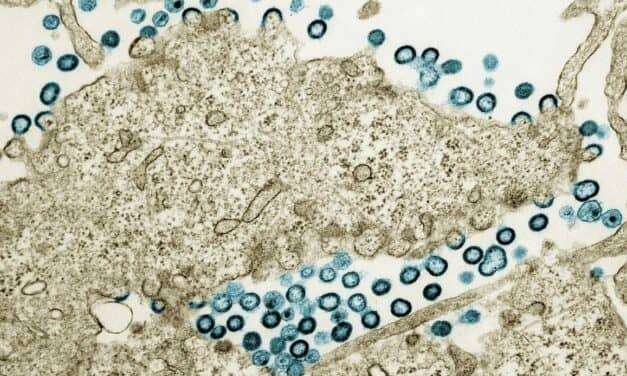 Certain HIV Drug Linked to Higher Cardiovascular Risk, NIH Study Finds