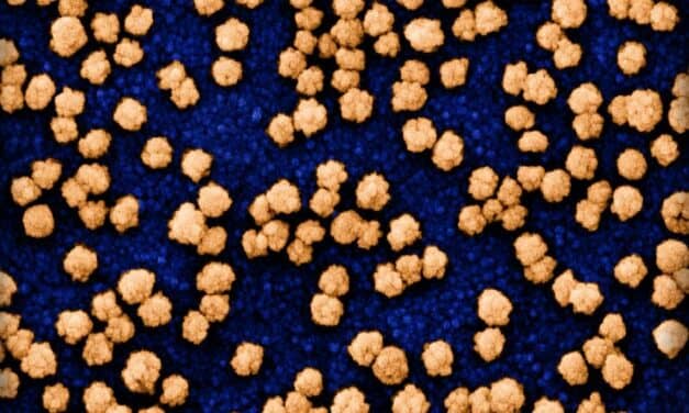 Heart Attack and Stroke Risk Remains Elevated Years After COVID-19 Infection