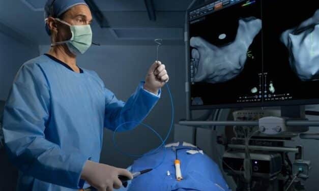 FDA Approves Johnson & Johnson’s Pulsed Field Ablation Platform for AFib