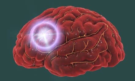 Antidiabetic Drug Shows Promise in Reducing Stroke Size and Severity