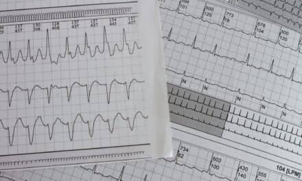 FDA Clears Credit Card-Sized ECG Device for On-Demand Home Arrhythmia Recording