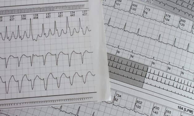 FDA Clears Credit Card-Sized ECG Device for On-Demand Home Arrhythmia Recording