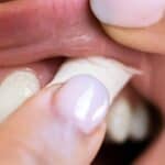 AHA Calls for Policies to Curb Use of Oral Nicotine Products