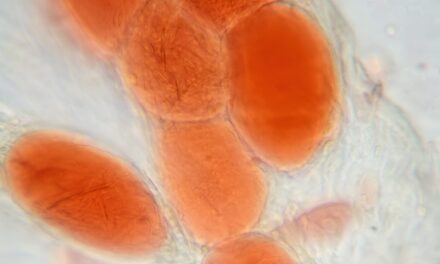 New MRI Technique Could Assess Heart Disease Risk by Analyzing Fat Around the Heart